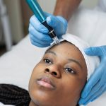 z-person-getting-micro-needling-beauty-treatment-10.jpg